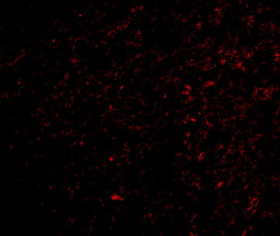 TOCA-1 Antibody in Immunocytochemistry (ICC/IF)