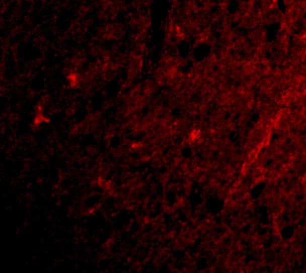 GRIK1 Antibody in Immunocytochemistry (ICC/IF)