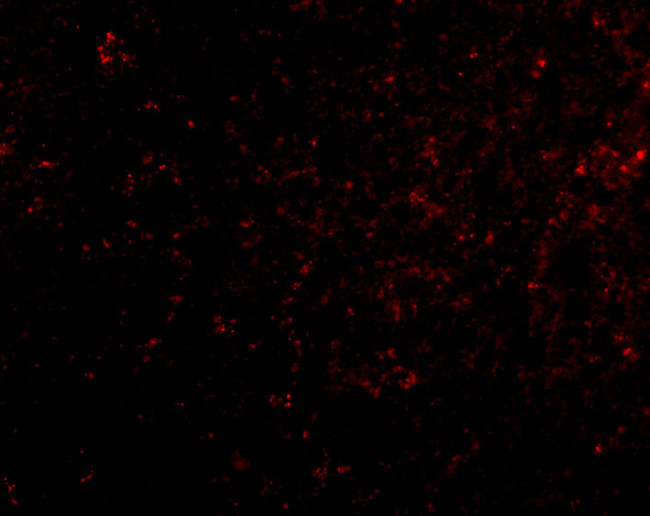 GRIK4 Antibody in Immunocytochemistry (ICC/IF)
