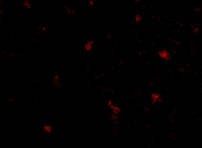 FEZ2 Antibody in Immunocytochemistry (ICC/IF)