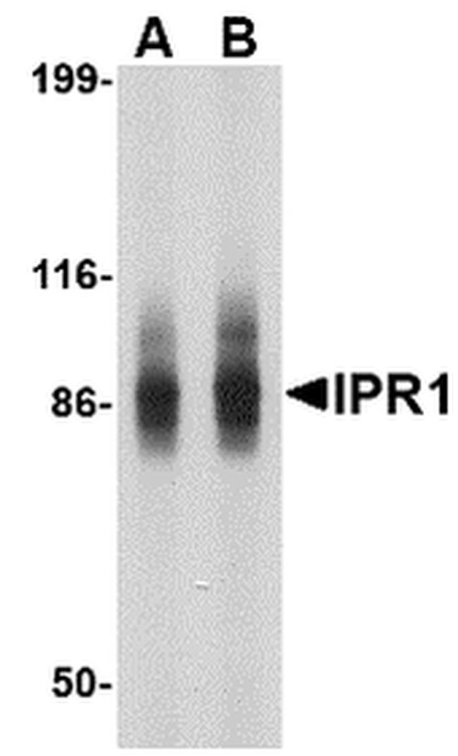 SP110 Antibody in Western Blot (WB)