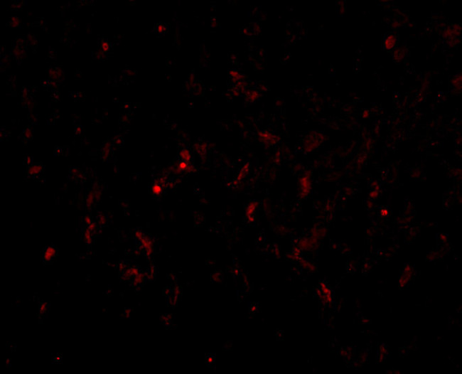 GSTP1 Antibody in Immunocytochemistry (ICC/IF)