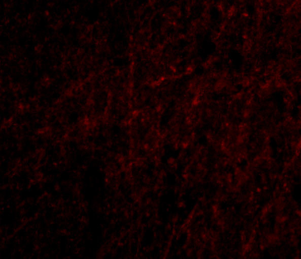 PLXDC2 Antibody in Immunocytochemistry (ICC/IF)