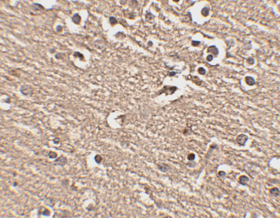 SLITRK1 Antibody in Immunohistochemistry (IHC)