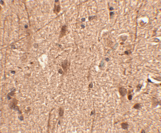 SLITRK3 Antibody in Immunohistochemistry (IHC)