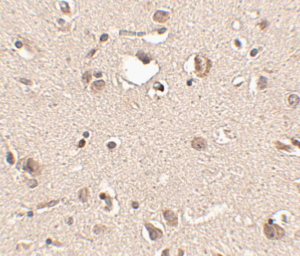 SLITRK3 Antibody in Immunohistochemistry (IHC)