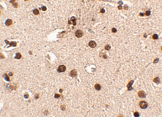 RIM3 Antibody in Immunohistochemistry (IHC)