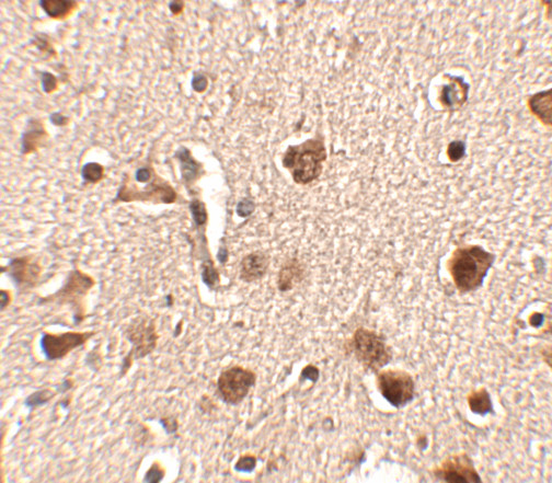 SLITRK4 Antibody in Immunohistochemistry (IHC)