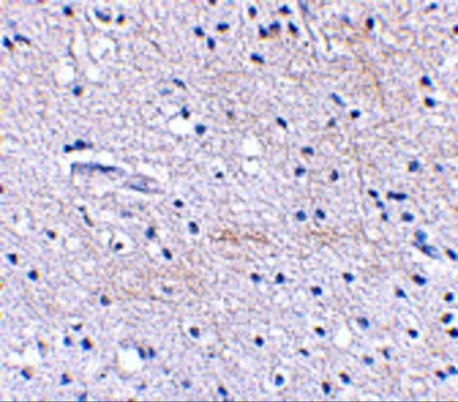 FBXL20 Antibody in Immunohistochemistry (IHC)