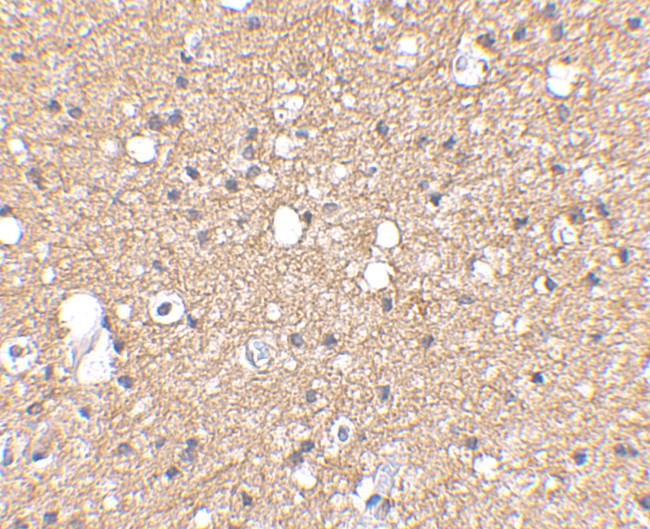 SIRT2 Antibody in Immunohistochemistry (IHC)