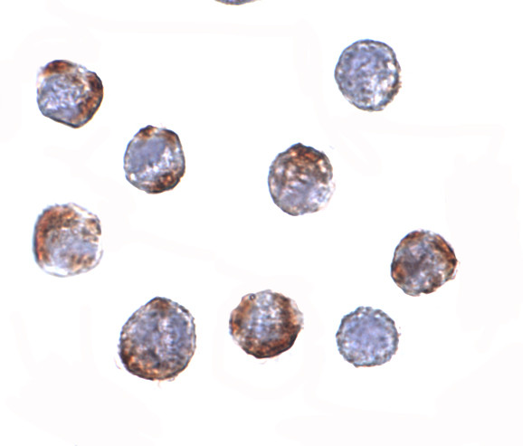 ATG16L1 Antibody in Immunocytochemistry (ICC/IF)