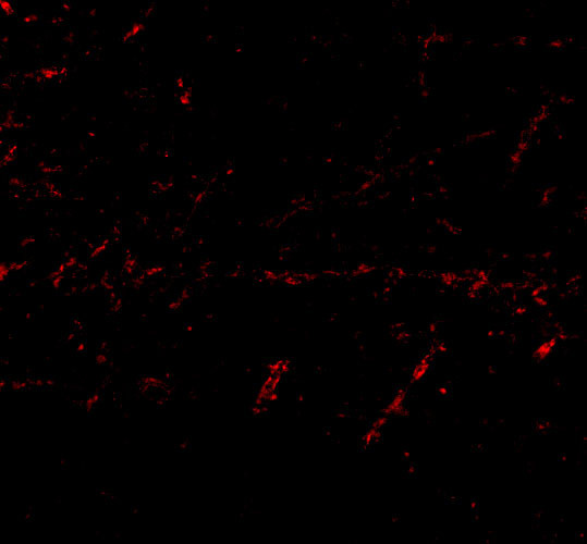 LGI1 Antibody in Immunocytochemistry (ICC/IF)