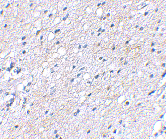 BAP3 Antibody in Immunohistochemistry (IHC)