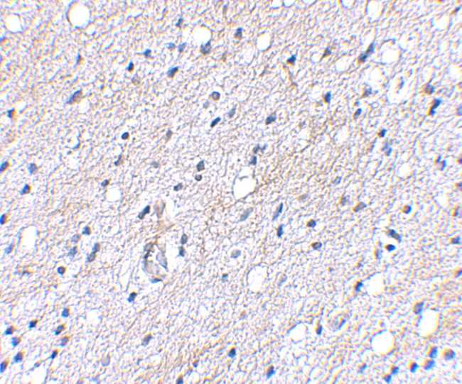 BAP3 Antibody in Immunohistochemistry (IHC)