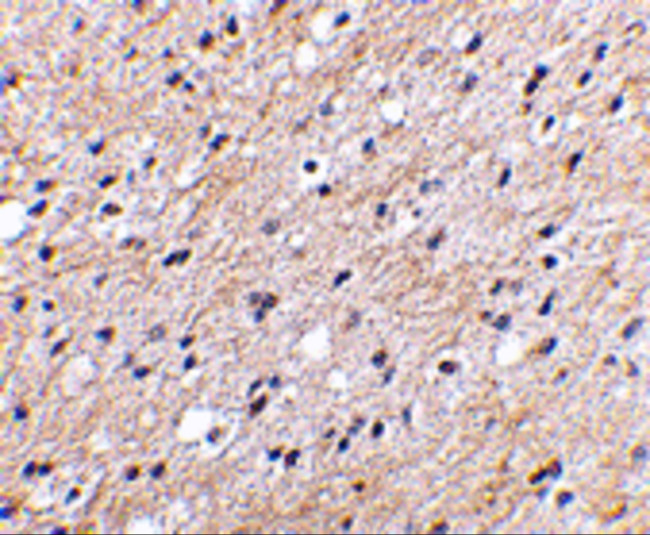 NIPSNAP1 Antibody in Immunohistochemistry (IHC)