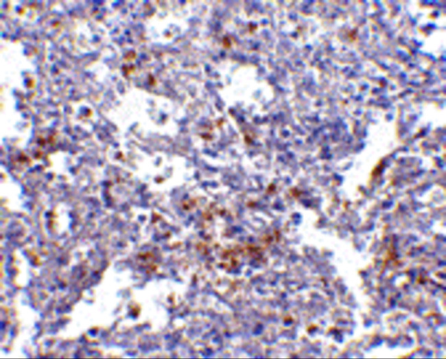 TMC6 Antibody in Immunohistochemistry (IHC)