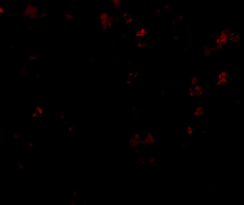 TMC6 Antibody in Immunocytochemistry (ICC/IF)