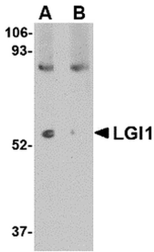 LGI1 Antibody in Western Blot (WB)