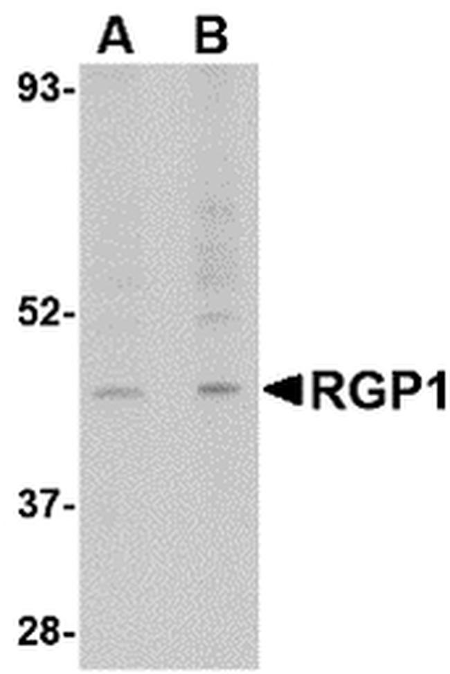 RGP1 Antibody in Western Blot (WB)