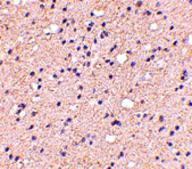 ELOVL6 Antibody in Immunohistochemistry (IHC)
