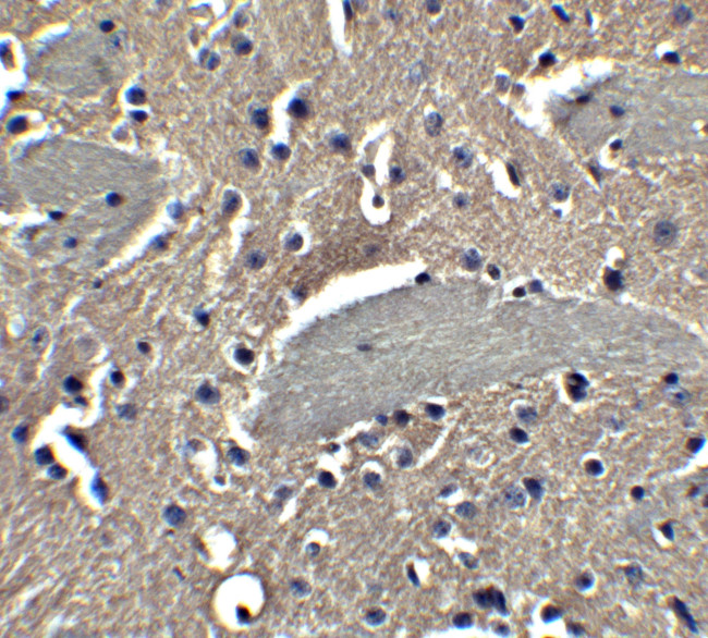 NPTX2 Antibody in Immunohistochemistry (Paraffin) (IHC (P))