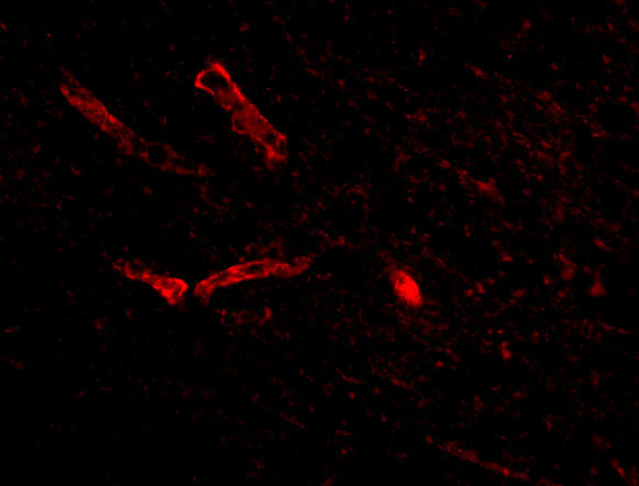 Syntaphilin Antibody in Immunocytochemistry (ICC/IF)