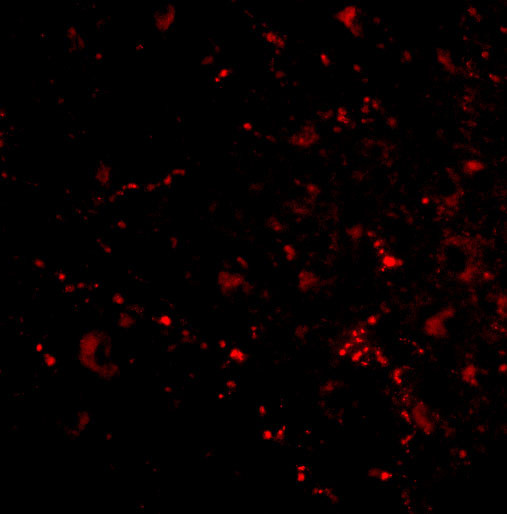 SATB2 Antibody in Immunocytochemistry (ICC/IF)