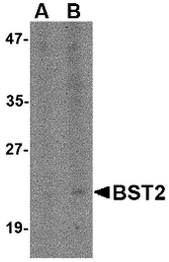 BST-2 Antibody in Western Blot (WB)