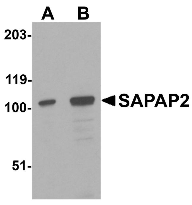 SAPAP2 Antibody in Western Blot (WB)