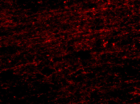 CLIP1 Antibody in Immunohistochemistry (IHC)