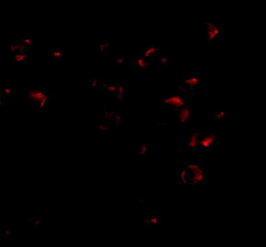 VPS53 Antibody in Immunocytochemistry (ICC/IF)