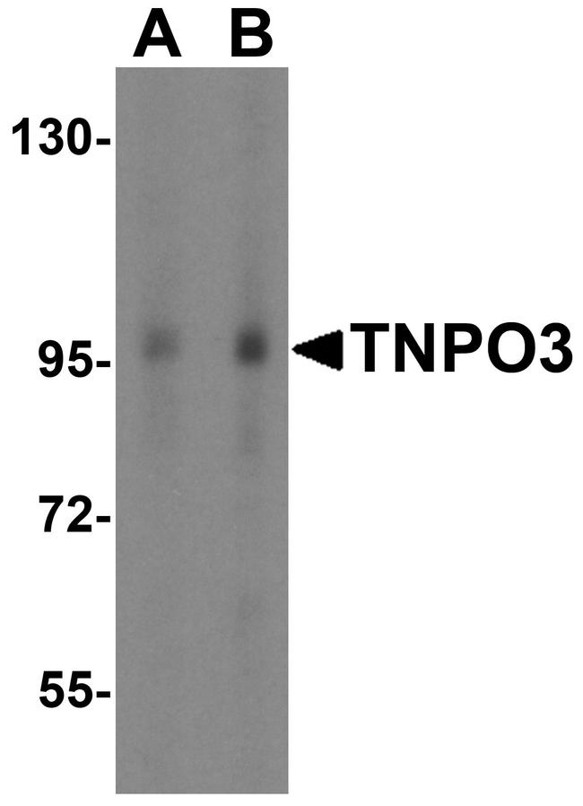 TNPO3 Antibody in Western Blot (WB)