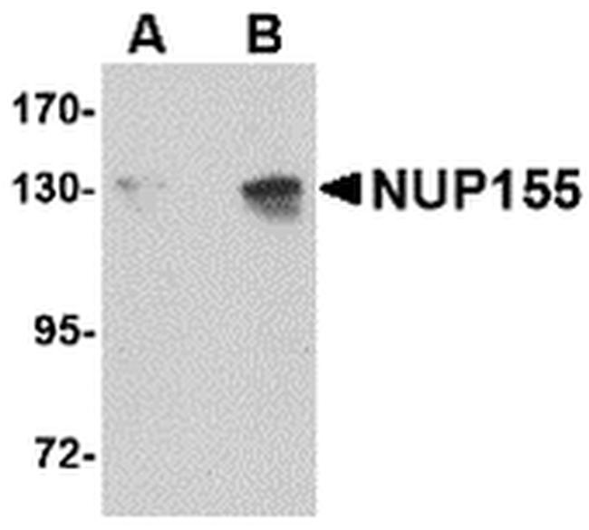 NUP155 Antibody in Western Blot (WB)