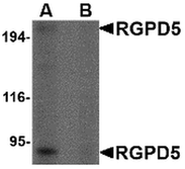 RGPD5 Antibody in Western Blot (WB)