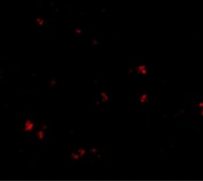 Lass5 Antibody in Immunohistochemistry (IHC)