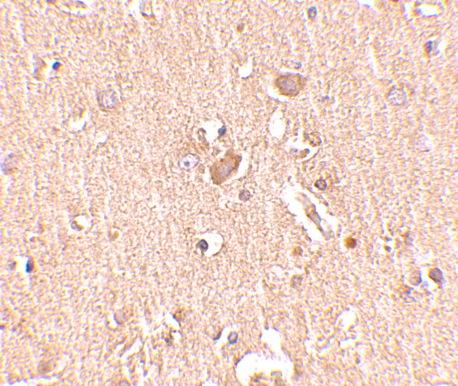 MED28 Antibody in Immunohistochemistry (IHC)