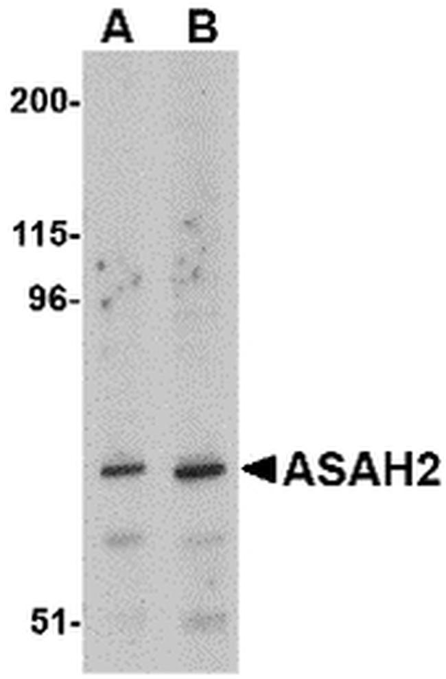 ASAH2 Antibody in Western Blot (WB)