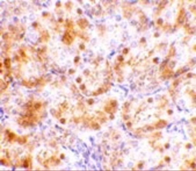 NENF Antibody in Immunohistochemistry (IHC)