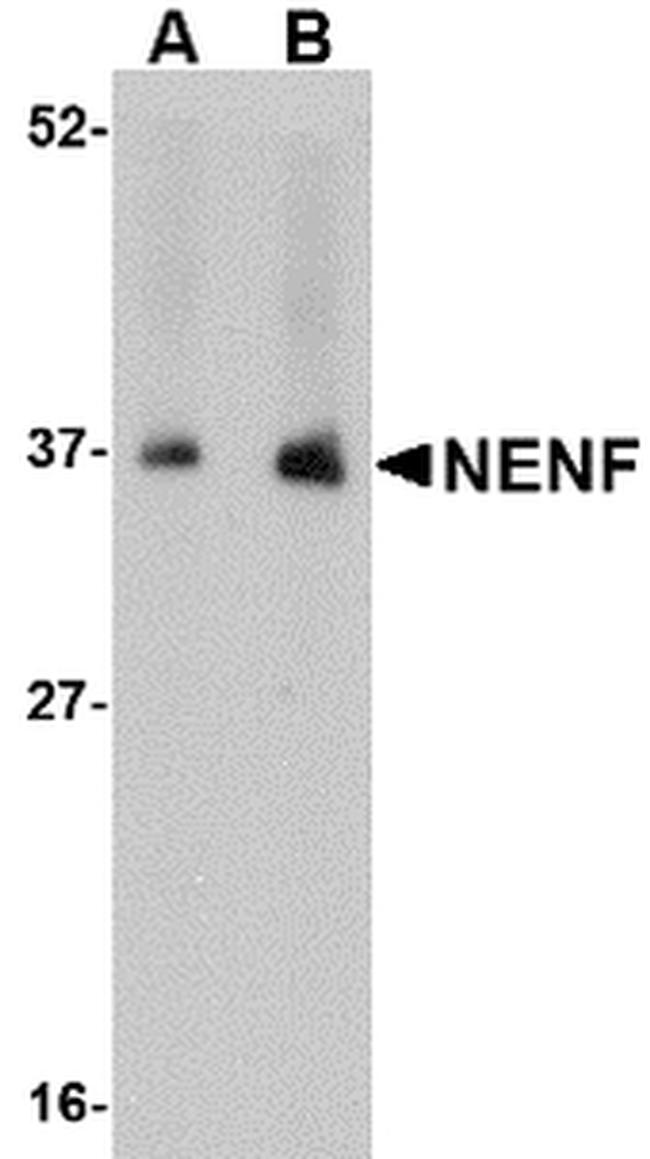NENF Antibody in Western Blot (WB)