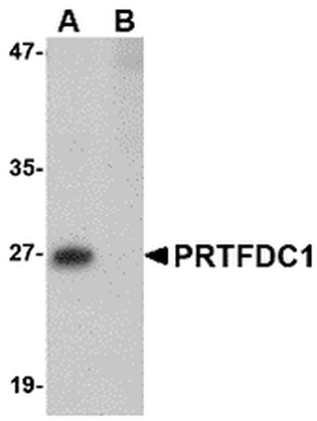 PRTFDC1 Antibody in Western Blot (WB)