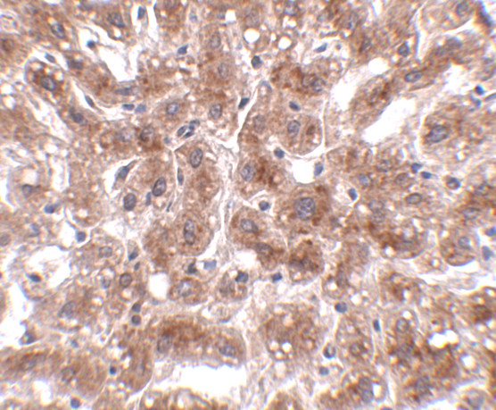 CUEDC1 Antibody in Immunohistochemistry (IHC)