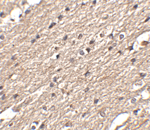SPRED3 Antibody in Immunohistochemistry (IHC)
