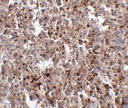 METTL7B Antibody in Immunohistochemistry (IHC)