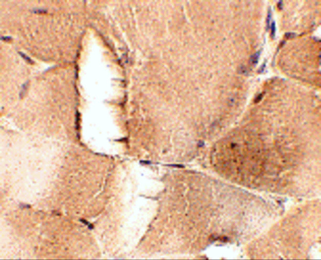JPH1 Antibody in Immunohistochemistry (IHC)