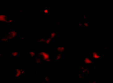 JPH3 Antibody in Immunocytochemistry (ICC/IF)
