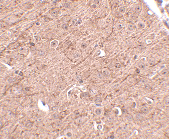 Lass5 Antibody in Immunohistochemistry (IHC)