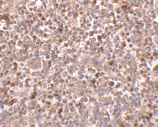 PIGY Antibody in Immunohistochemistry (IHC)