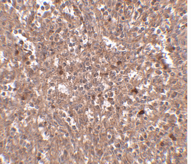 PIGY Antibody in Immunohistochemistry (IHC)