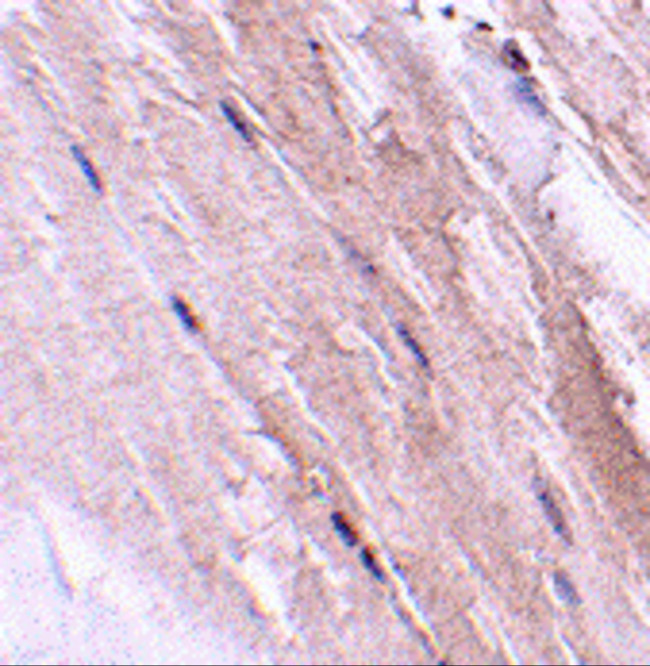 GBAS Antibody in Immunohistochemistry (IHC)