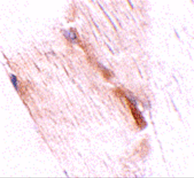GBAS Antibody in Immunohistochemistry (IHC)